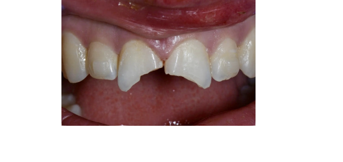 Before